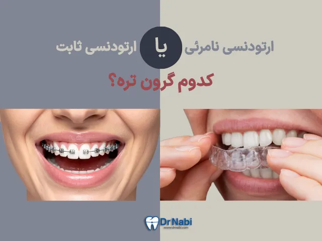 ارتودنسی نامرئی گرانتر است یا سیمی؟