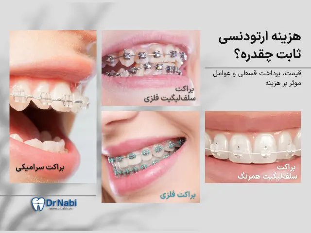 قیمت ارتودنسی ثابت در تهران + شرایط اقساط