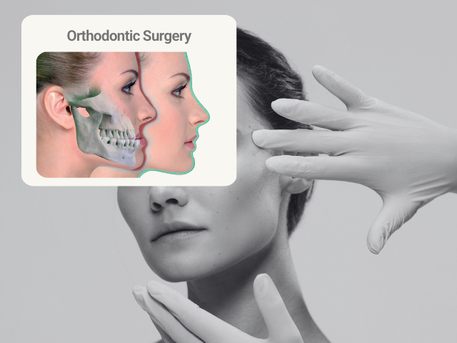 ارتو سرجری (جراحی فک ) چیست؟  ـ  راهنمای کامل قبل از تصمیم به جراحی