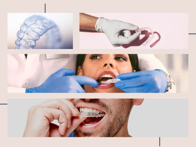 ارتودنسی نامرئی - مزایا، هزینه و الاینر شفاف با دکتر نبی