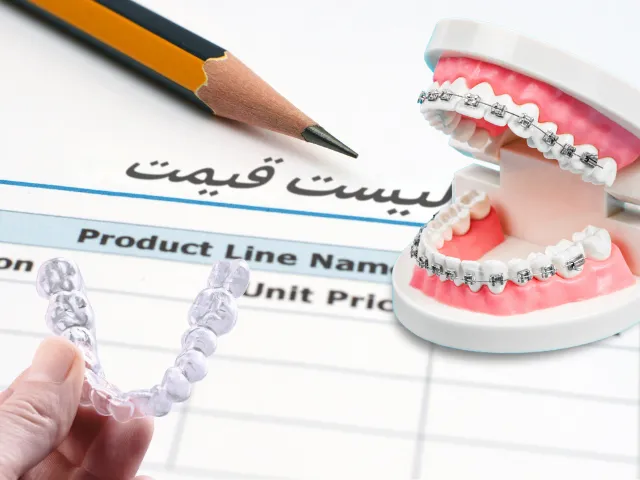 هزینه ارتودنسی  -  قیمت ارتودنسی ثابت و نامرئی + اقساط