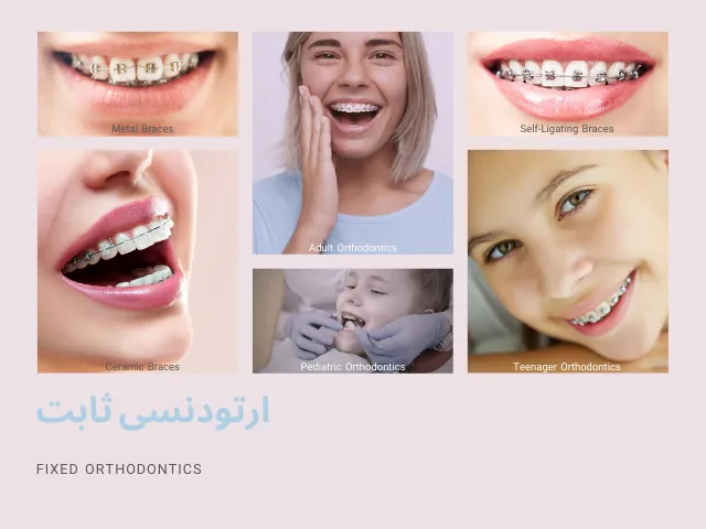 ارتودنسی ثابت صفر تا صد - درمان دقیق نامرتبی دندانها و مشکلات فکی زیر نظر دکتر نبی