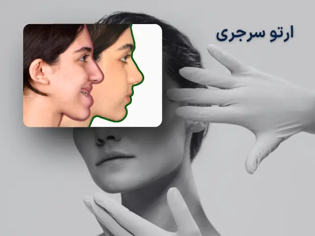 ارتو سرجری (جراحی فک ) چیست؟  ـ  راهنمای کامل قبل از تصمیم به جراحی