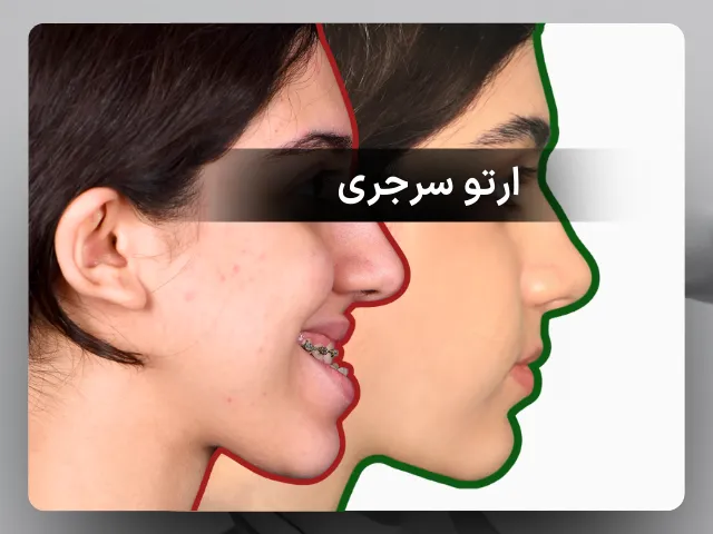 ارتو سرجری (جراحی فک ) چیست؟