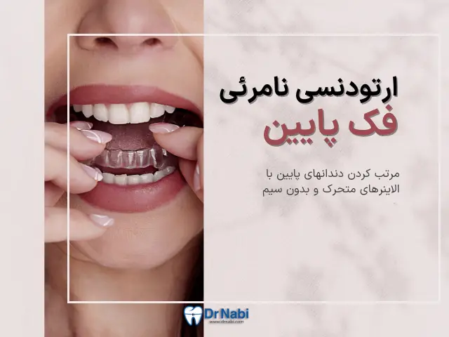 آیا ارتودنسی نامرئی فقط برای فک پایین امکان پذیر است؟