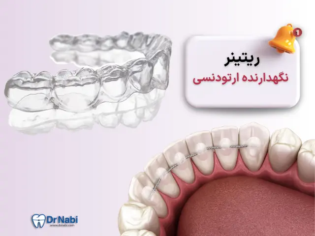 نگهدارنده  ارتودنسی(ریتینر) چیست و چرا بعد از درمان باید استفاده کنی؟