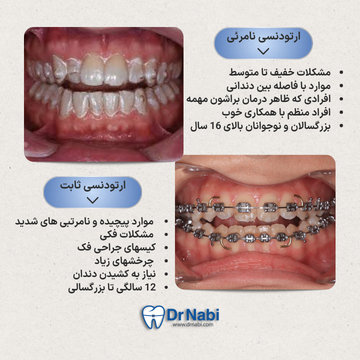 مقایسه ارتودنسی نامرئی و ثابت نما میدلاین داخل دهان با الاینر شفاف روی دندانها، نما میدلاین داخل دهان با براکت و سیم روی دندانها و مقایسه موردی ارتودنسی ثابت و نامرئی به صورت متن در یک تصویر