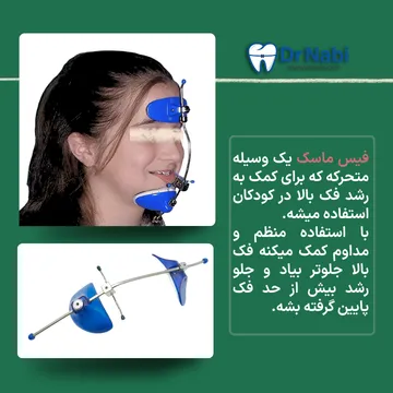 فیس ماسک در درمان جلو بودن فک پایین کودک در حال استفاده از فیس ماسک و تصویر جداگانه فیس ماسک، ابزار ارتودنسی برای اصلاح جلو بودن فک پایین در کودکان.