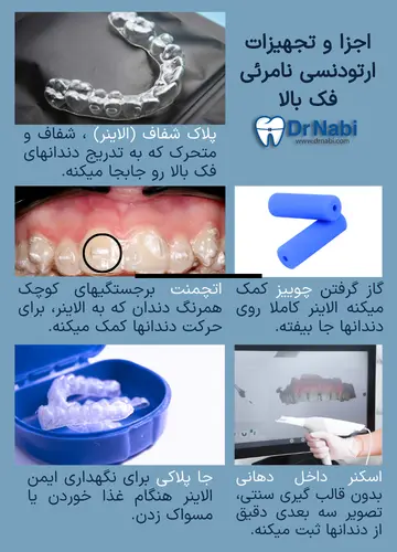 اجزا و تجهیزات ارتودنسی نامرئی فک بالا الاینر فک بالا، اتچمنت، چوییز، اسکنر داخل دهانی و جاپلاکی در ارتودنسی نامرئی.