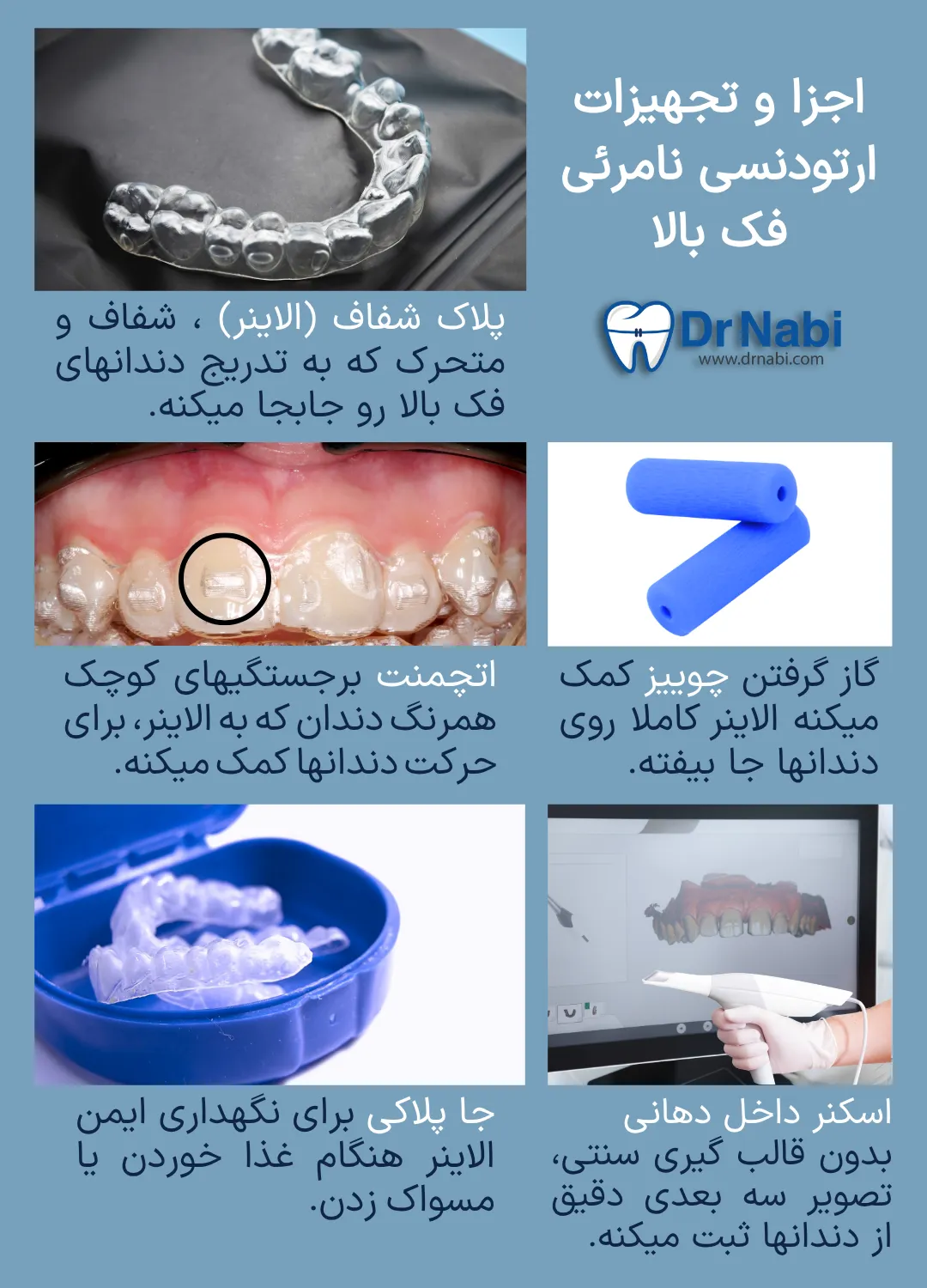 آشنایی با اجزا و تجهیزات ارتودنسی نامرئی فک بالا الاینر فک بالا، اتچمنت، چوییز، اسکنر داخل دهانی و جا پلاکی در ارتودنسی نامرئی.