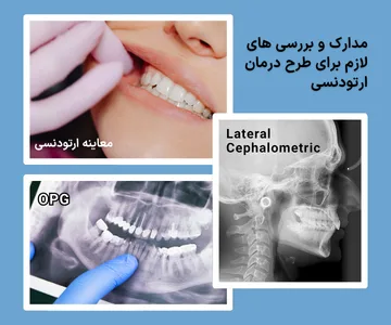 معاینه دندان ها همراه با رادیوگرافی پانورامیک و لترال سفالومتری برای بررسی قبل از ارتودنسی