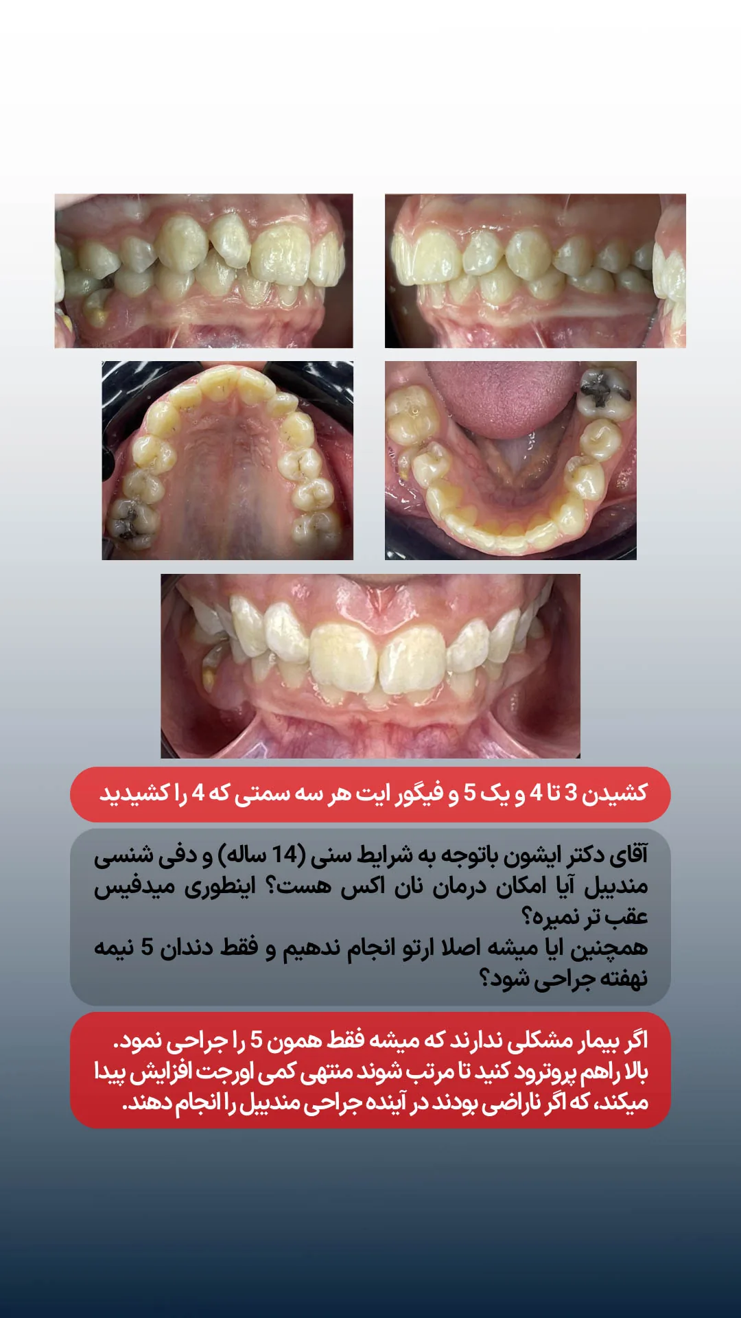 بخش اول پرسش دندانپزشک درباره طرح درمان کیس ارتودنسی کشیدنی