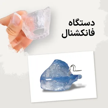 نمونه دستگاه فانکشنال ارتودنسی اطفال دو نمونه دستگاه فانکشنال ارتودنسی اطفال برای درمان کلاس 2 کودکان در یک تصویر