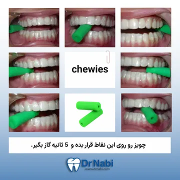 استفاده از Chewie برای بهتر نشستن الاینر