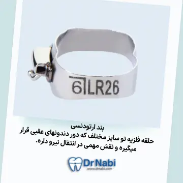 بند ارتودنسی ثابت تصویر بند ارتودنسی ثابت با توضیح کامل به صورت متن