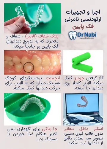 الاینر فک پایین، اتچمنت فک پایین، چوییز، اسکنر داخل دهانی و جا پلاکی در ارتودنسی نامرئی.