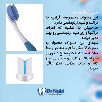 مسواک ارتودنسی ثابت با طراحی V شکل برای تمیز کردن اطراف براکت و سیم