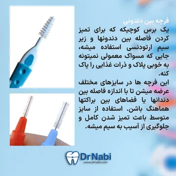 فرچه بین دندانی کوچک برای تمیز کردن اطراف براکت و زیر سیم
