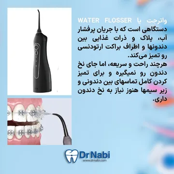 واترجت دندانپزشکی برای تمیز کردن اطراف براکت و لثه با فشار آب
