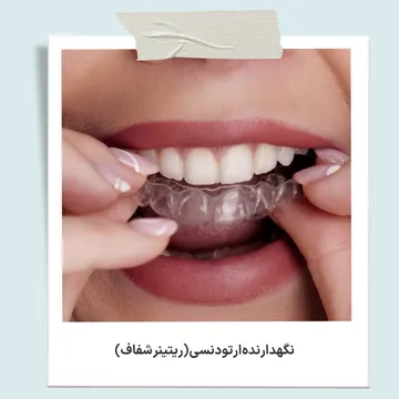 نگهدارنده شفاف ارتودنسی یا ریتینر شفاف برای جلوگیری از بازگشت دندان ها پس از پایان درمان