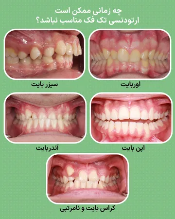 نمونه هایی از ناهنجاری های بایت و رابطه فکی شامل اپن بایت، اوربایت، آندربایت، کراس بایت و جلو بودن فک بالا که ممکن است نیاز به درمان هر دو فک داشته باشند