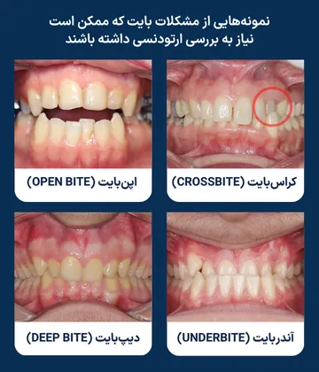 کلاژ تصاویر داخل دهانی بیماران با کراس بایت، اپن بایت، آندربایت و دیپ بایت؛ نمونه هایی از ناهنجاری های بایت که در ارزیابی ارتودنسی بررسی می شوند.