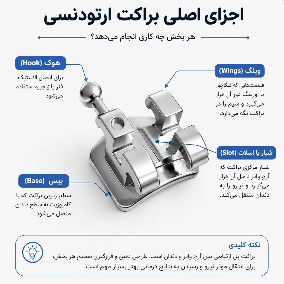 اجزای اصلی براکت ارتودنسی شامل اسلات، وینگ، بیس و هوک